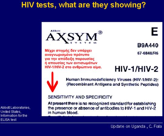 Τεστ HIV